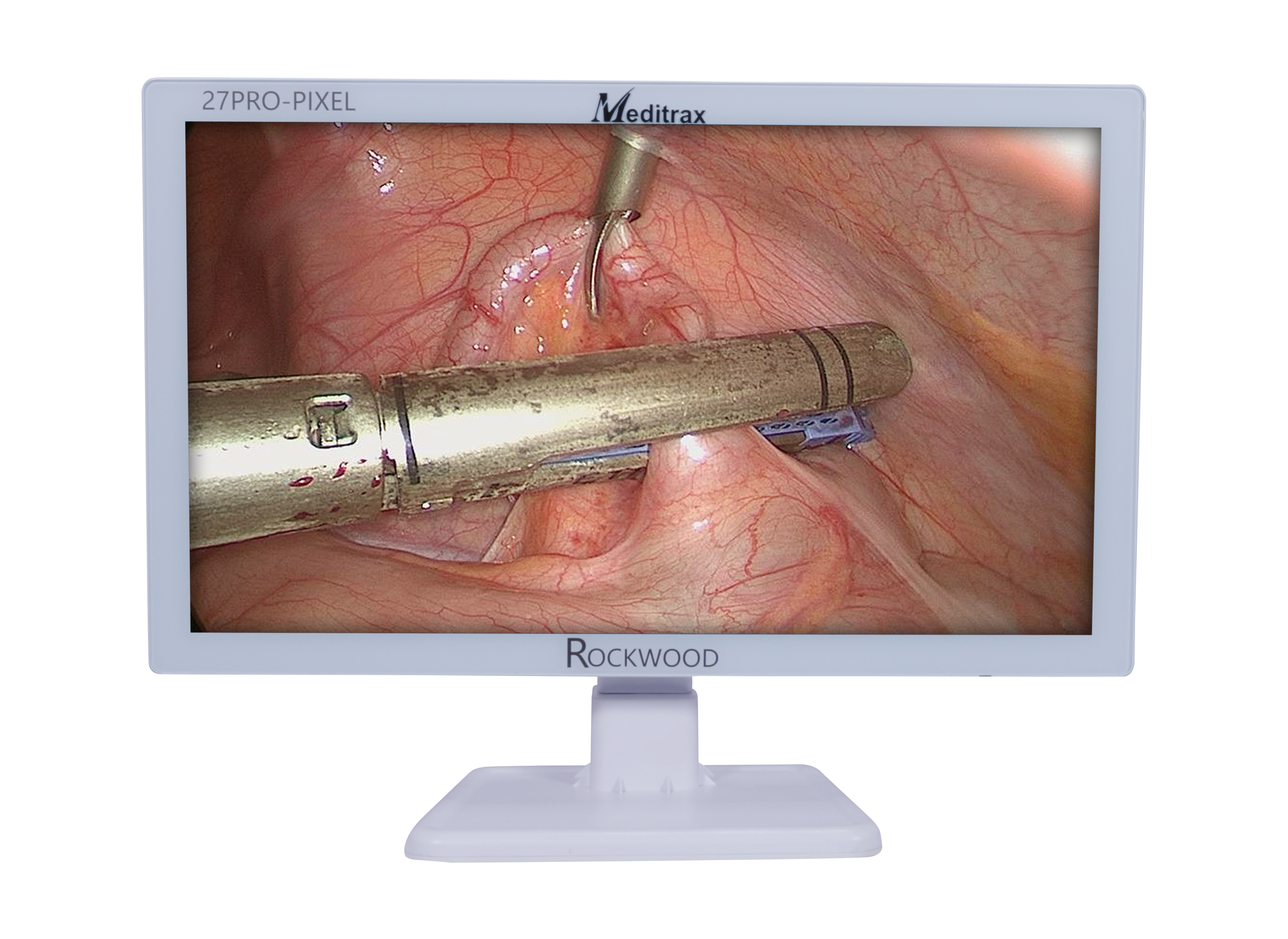 Full HD Medical Display Meditrax Equipments Laparoscopy Surgery ENT Urology