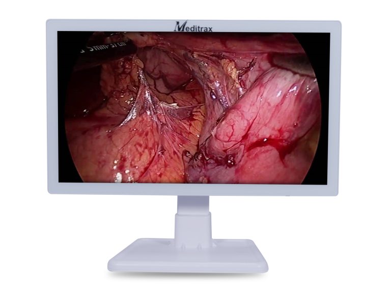 Full HD Medical Display Meditrax Equipments Laparoscopy Surgery ENT Urology 24 inch Display